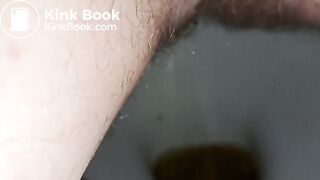 Diarrhea