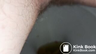 Diarrhea