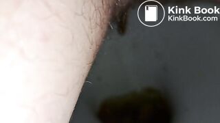 Diarrhea