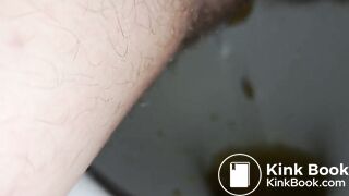 Diarrhea