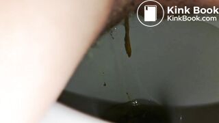 Diarrhea