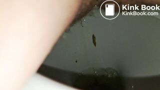 Diarrhea