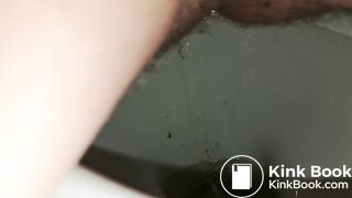 Diarrhea
