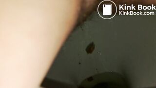 Diarrhea