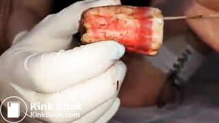 Speculum full of poop - part 2