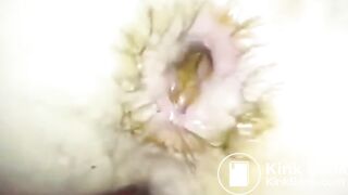 Shit Fucking