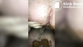 North London Shit Pig