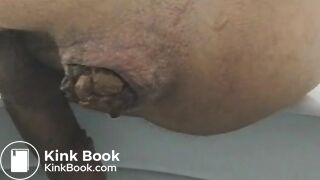 Huge poop constipated