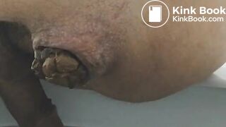 Huge poop constipated