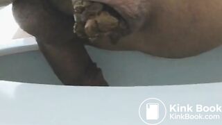 Huge poop constipated