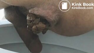 Huge poop constipated