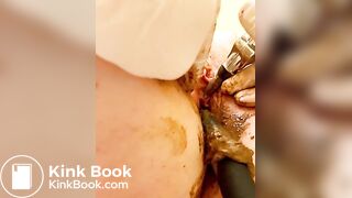 Scat urethra until anal urination