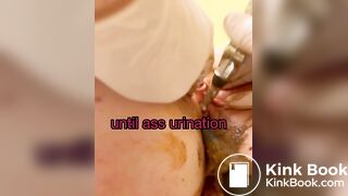 Scat urethra until anal urination
