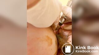 Scat urethra until anal urination