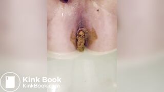 My own scat