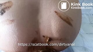 Scat anal with dirty creampie