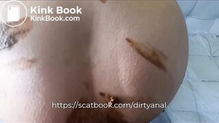 very very dirty anal with a lot of poop with cream - Dirty Anal & Ass to Mouth