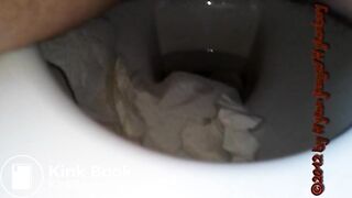 Kackewürste rausdrücken