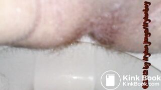 Kackewürste rausdrücken