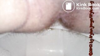 Kackewürste rausdrücken