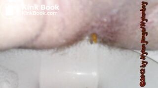 Kackewürste rausdrücken