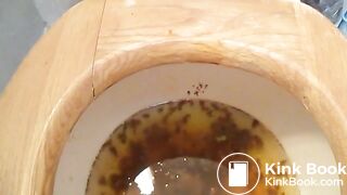 2015-02-17 diarrhea