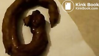 dog shit