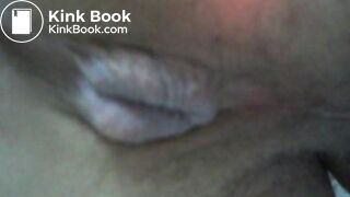 My asscunt swelling and shitting