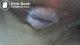 My asscunt swelling and shitting