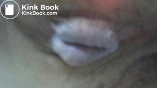 My asscunt swelling and shitting