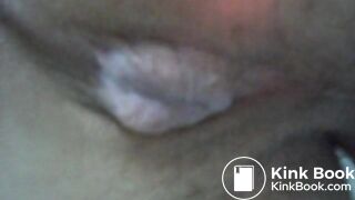 My asscunt swelling and shitting