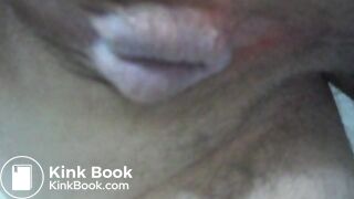 My asscunt swelling and shitting