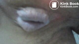 My asscunt swelling and shitting