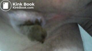 My asscunt swelling and shitting