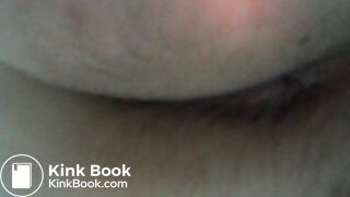 My asscunt swelling and shitting