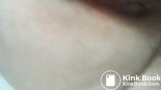 My asscunt swelling and shitting