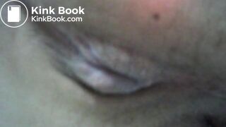 My asscunt swelling and shitting