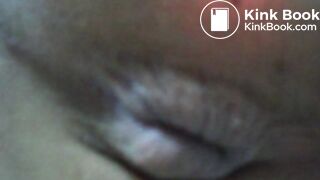 My asscunt swelling and shitting