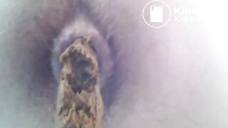 amateur teen boy scat