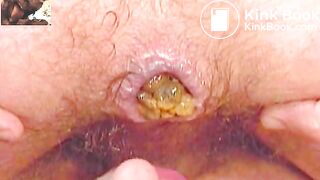 Scat - Gay Shit Eating Memories 01 - Scheisse