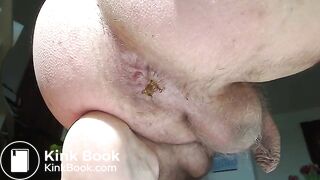 Video 2