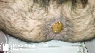 Turd_1