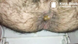 Turd_1
