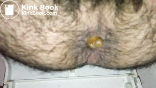 Turd_1