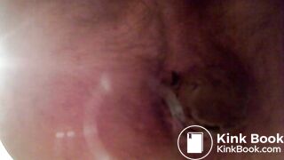 Video 35