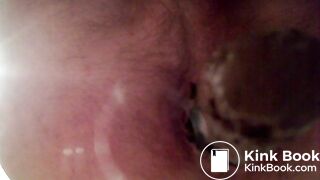 Video 35