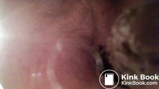 Video 35