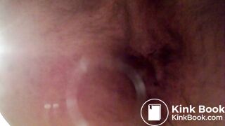 Video 35