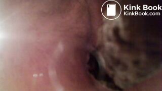 Video 35