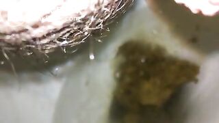Me shitting
